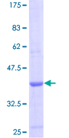 12.5% SDS-PAGE Stained with Coomassie Blue.